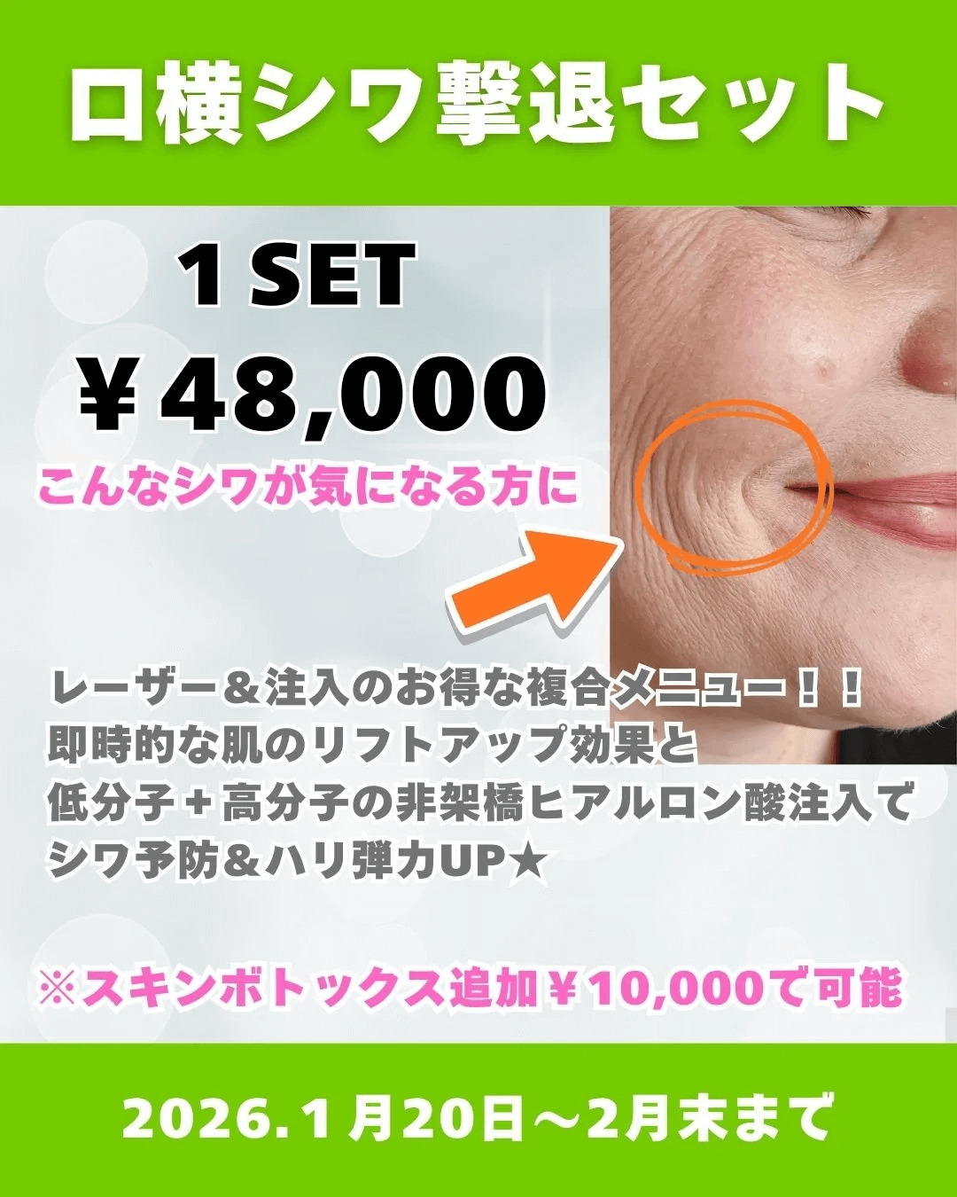 口横シワ撃退セット